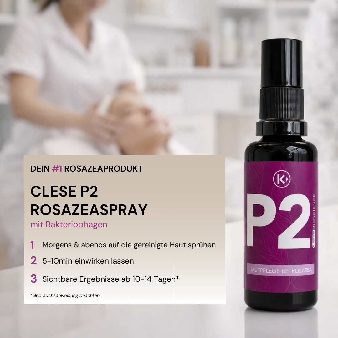 clese P2 - Bei Rosazea