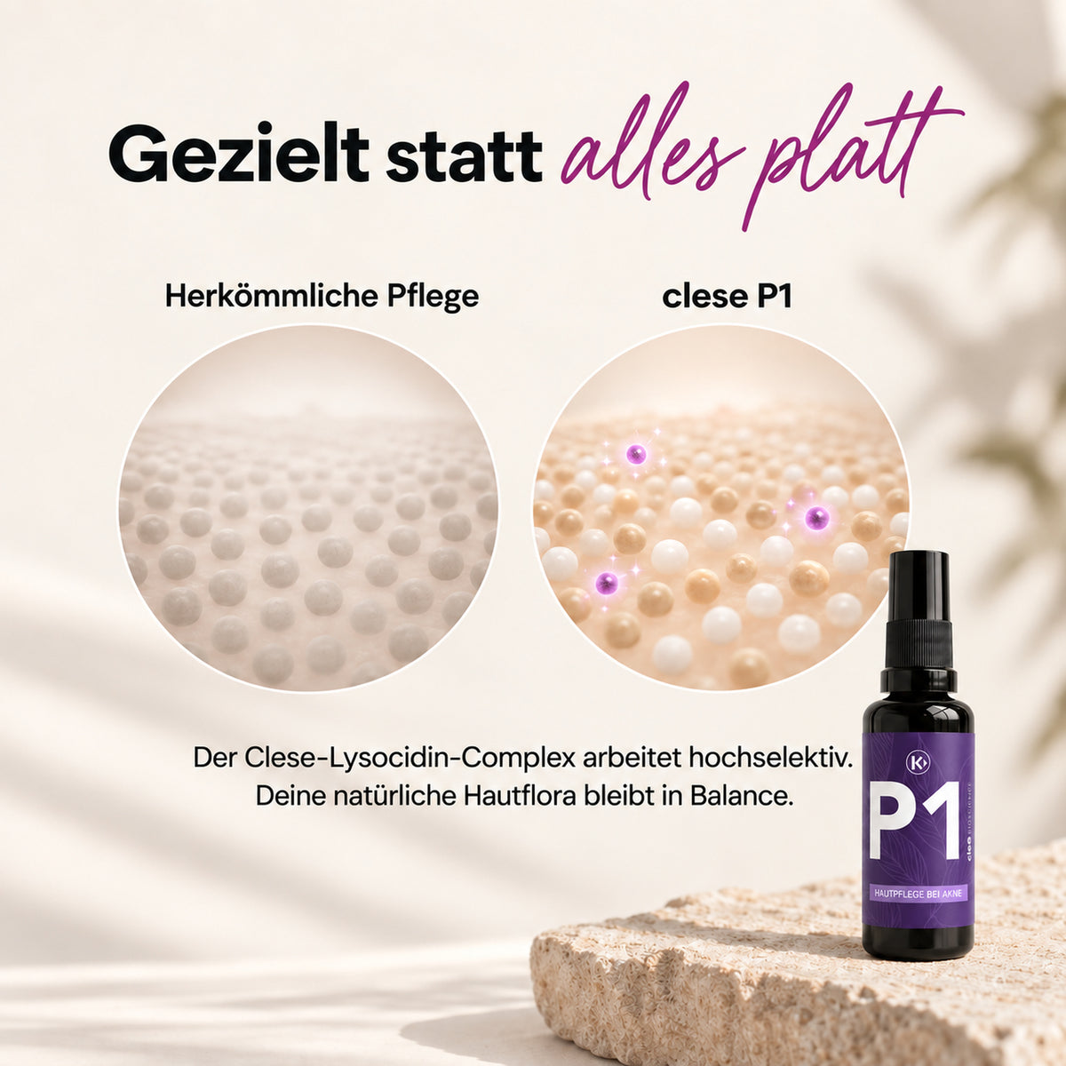 clese P1 - Bei Akne