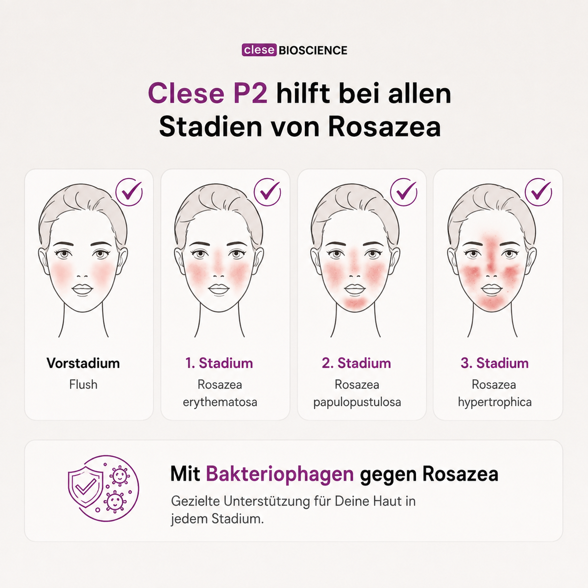clese P2 - Bei Rosazea - cleseBIOSCIENCE